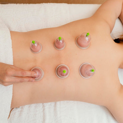 The complete Vacuum Cupping Set with all six cups and pump for deep tissue massage.